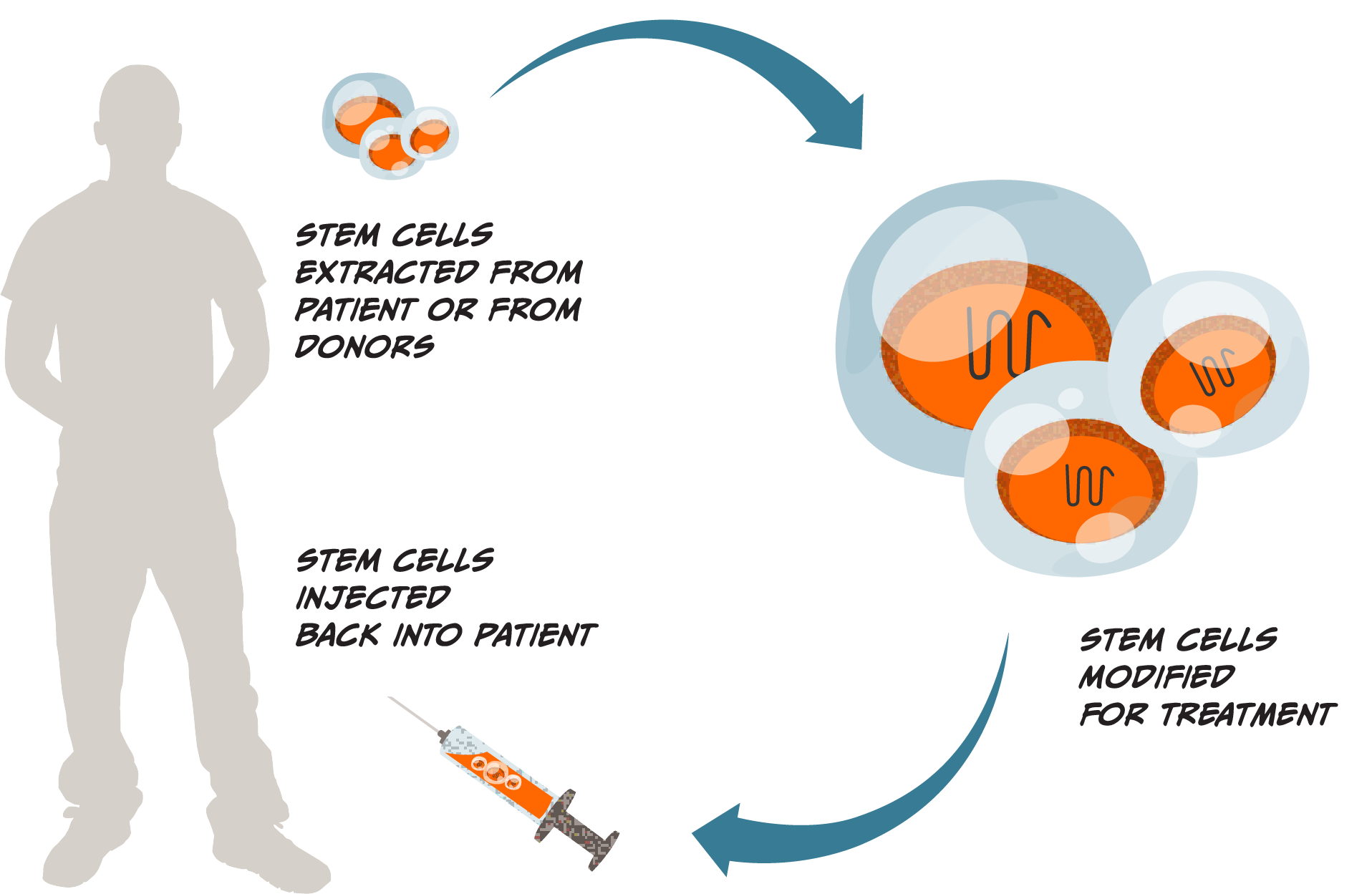 Illustrative diagram showing three steps for how cell therapy works. One, stem cells are extracted from a patient or donor, the cells and patient are illustrated with an arrow pointing to the next step. Two, stem cells are modified for treatment, a larger cluster of stem cells are illustrated, with an arrow pointing to the final step. Three, stem cells are injected back into the patient, with a syringe illustrated near the illustration of the patient.