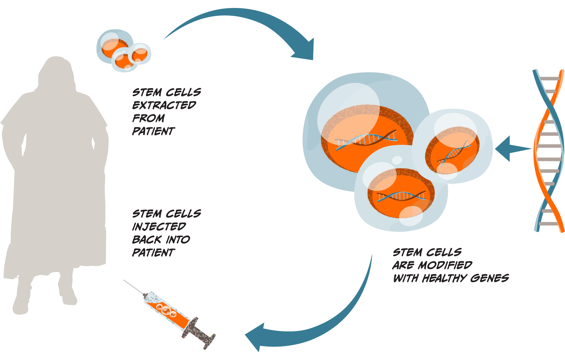 Illustrative diagram showing three steps for how cell-based gene therapy works. One, stem cells are extracted from a patient, the cells and patient are illustrated with an arrow pointing to the next step. Two, stem cells are modified with healthy genes, a larger cluster of stem cells are illustrated, with healthy genes being inserted into them, and an arrow pointing to the final step. Three, stem cells are injected back into the patient, with a syringe illustrated near the illustration of the patient.