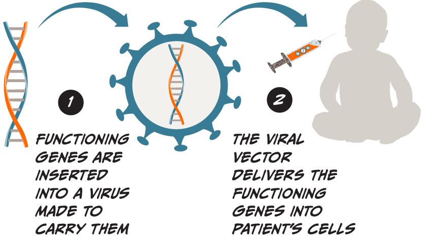 Illustrative diagram showing two steps for how gene therapy works. One, functioning genes are inserted into a virus made to carry them, a double helix and virus cell are illustrated with an arrow pointing to the next step. Two, The viral vector delivers the functioning genes into the patient's cells, with a syringe containing the viral vector near an illustration of the patient.